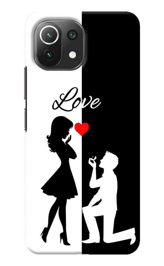 Love Propose Black And White Mi 11 Lite Back Cover