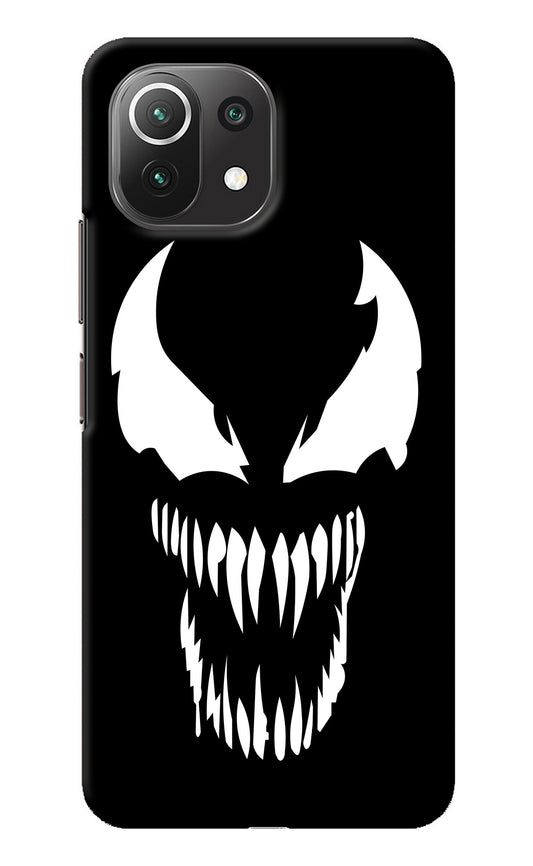 Venom Mi 11 Lite Back Cover