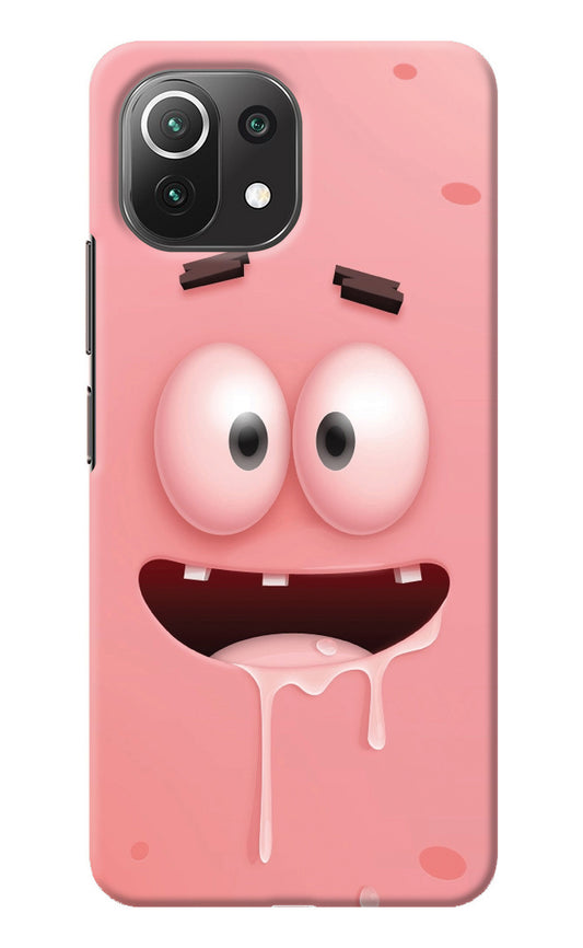 Sponge 2 Mi 11 Lite Back Cover