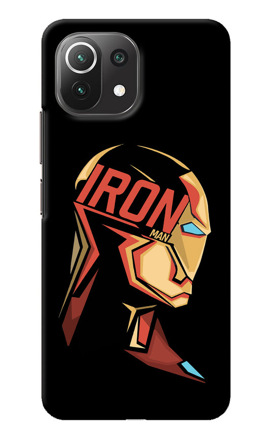 IronMan Mi 11 Lite Back Cover