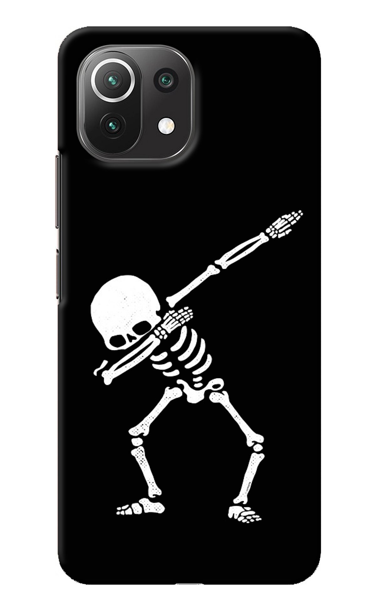 Dabbing Skeleton Art Mi 11 Lite NE 5G Back Cover