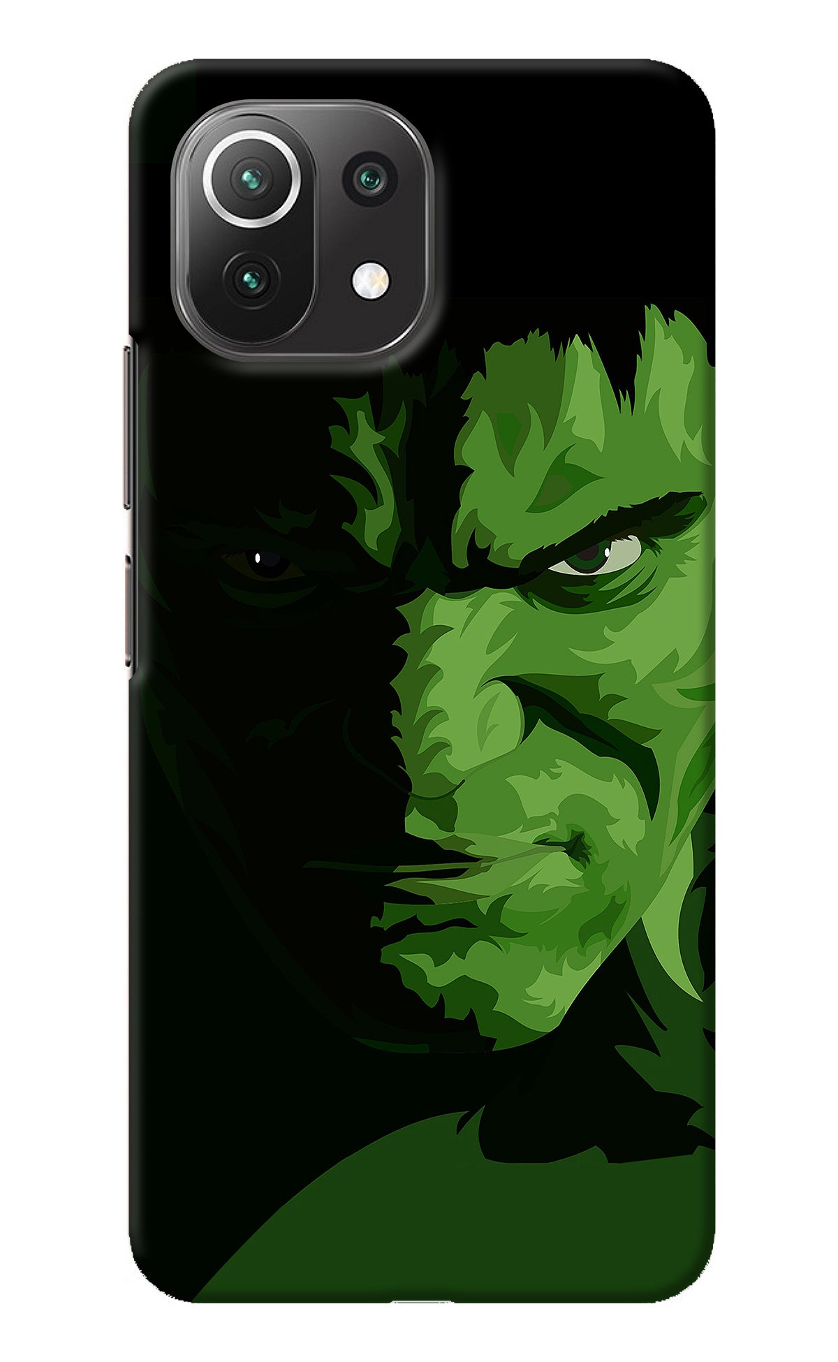 HULK Mi 11 Lite NE 5G Back Cover