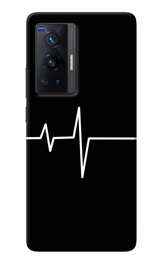 Heart Beats Vivo X70 Pro Back Cover