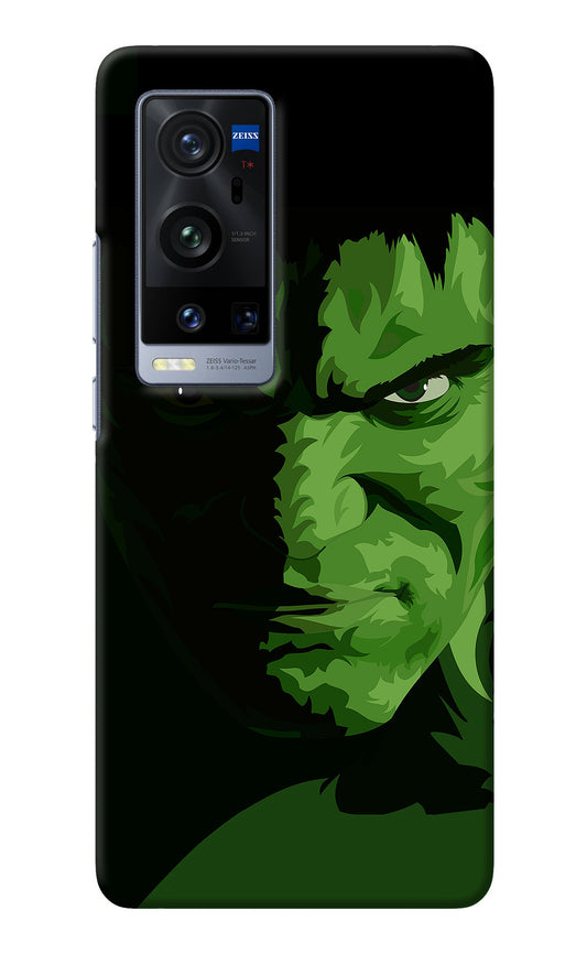 HULK Vivo X60 Pro+ Back Cover