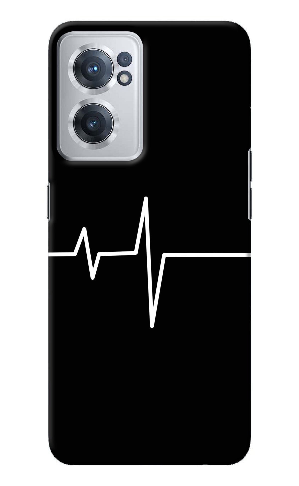 Heart Beats OnePlus Nord CE 2 5G Back Cover