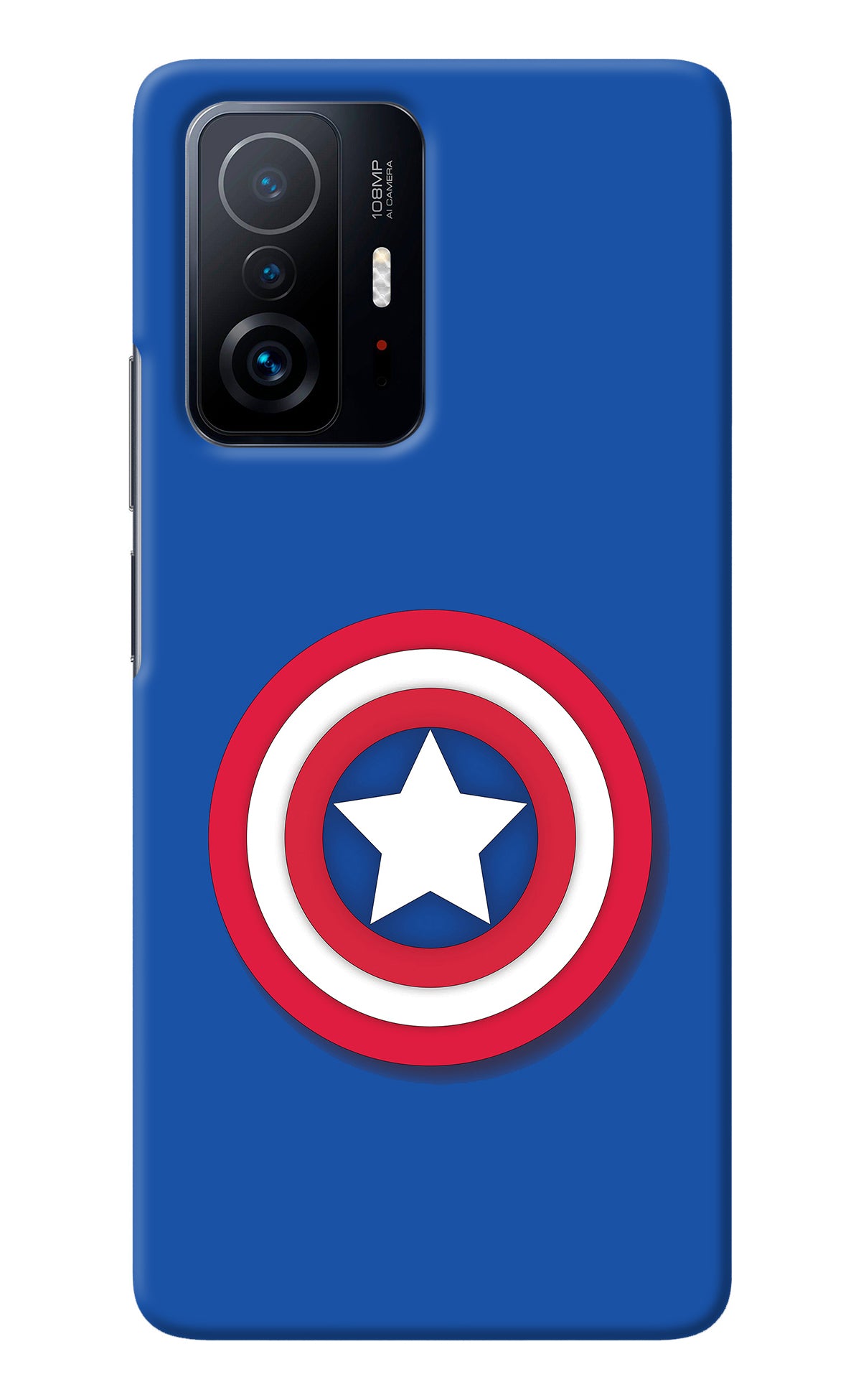 Shield Mi 11T Pro 5G Back Cover