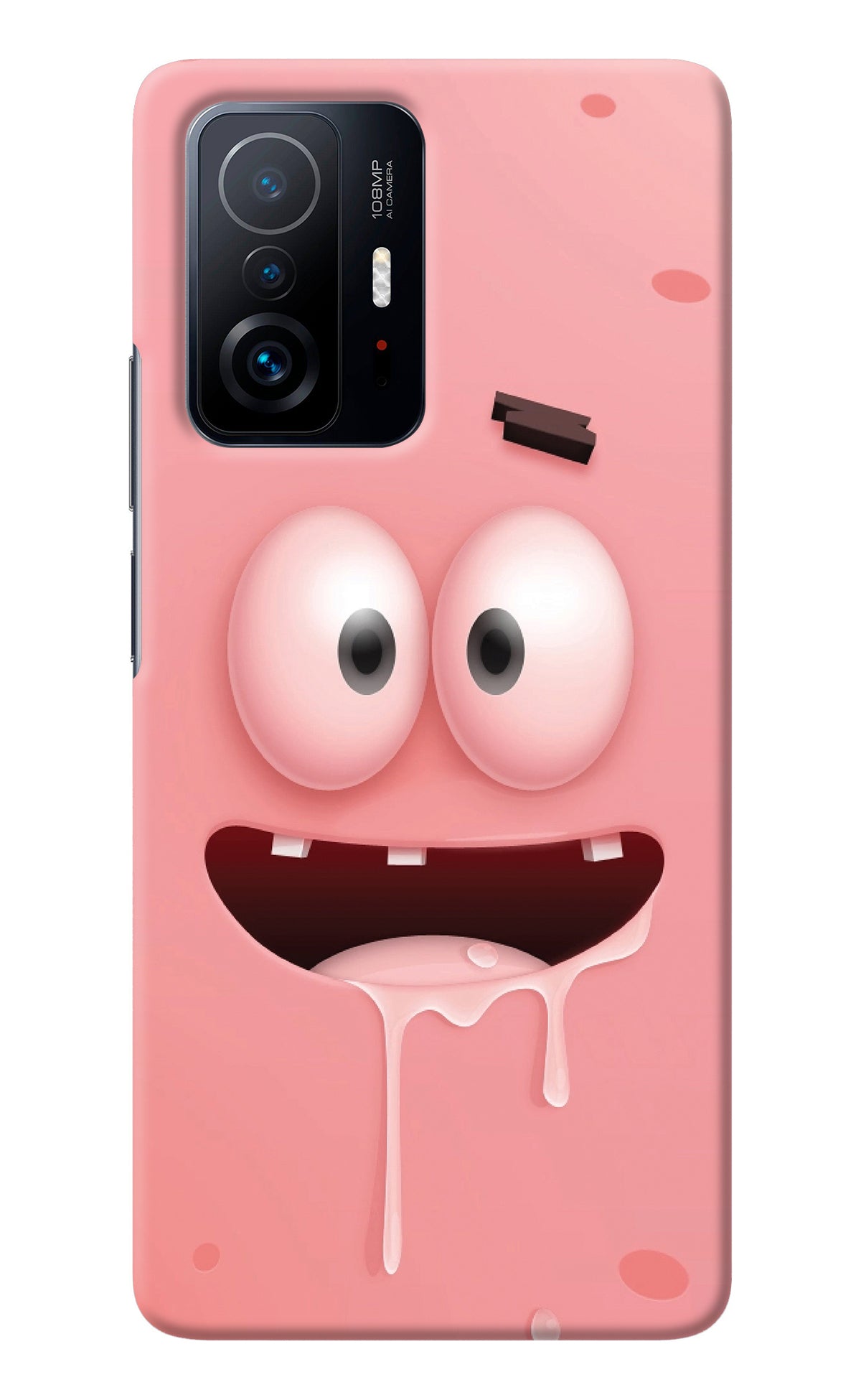 Sponge 2 Mi 11T Pro 5G Back Cover