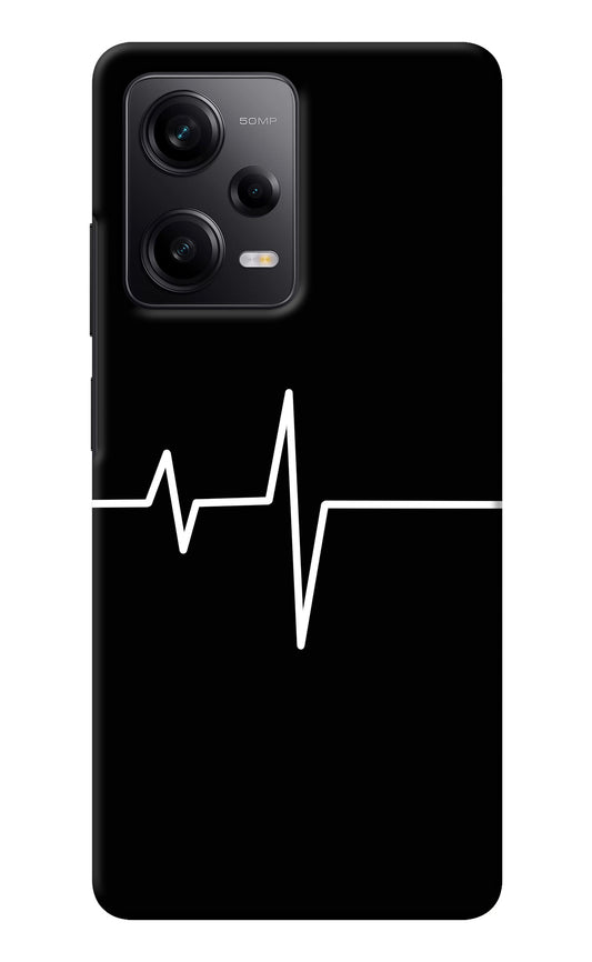 Heart Beats Redmi Note 12 Pro 5G Back Cover