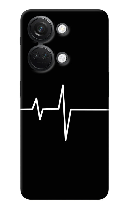 Heart Beats OnePlus Nord 3 5G Back Cover