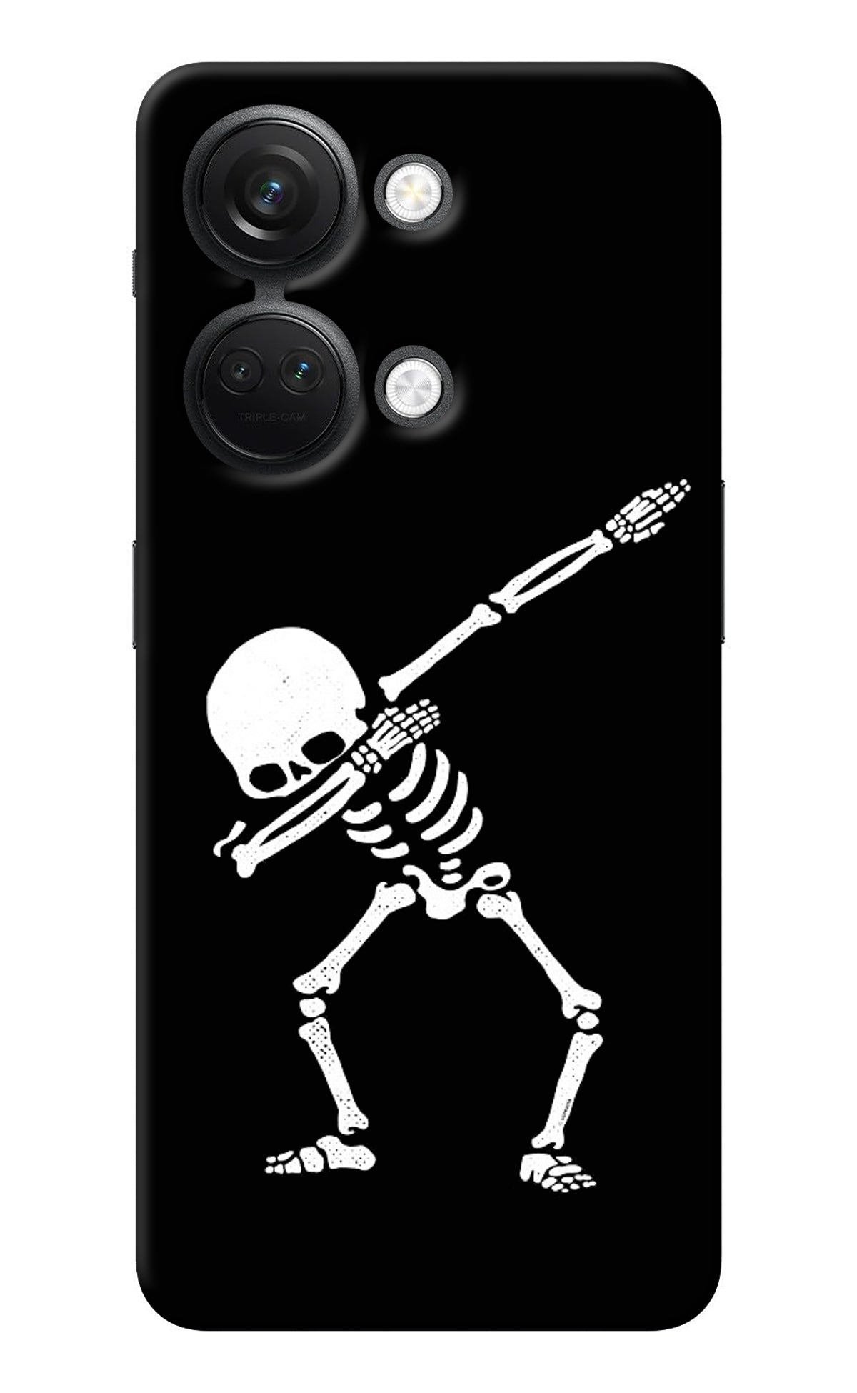 Dabbing Skeleton Art OnePlus Nord 3 5G Back Cover