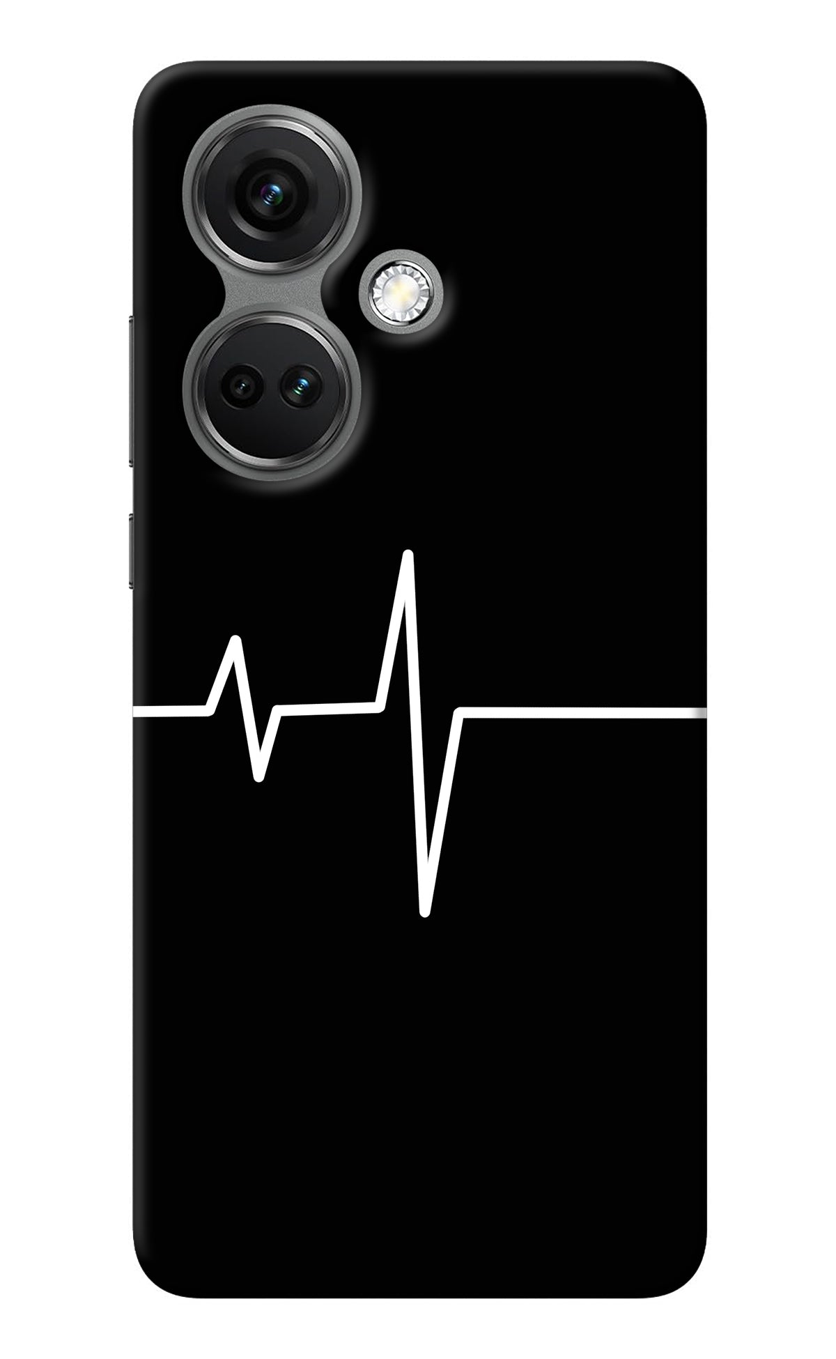 Heart Beats OnePlus Nord CE 3 5G Back Cover