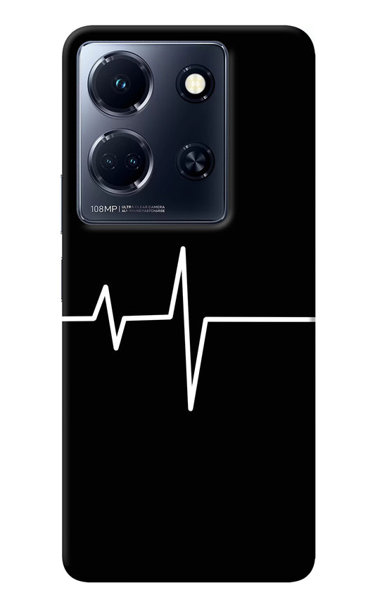 Heart Beats Infinix Note 30 5g Back Cover