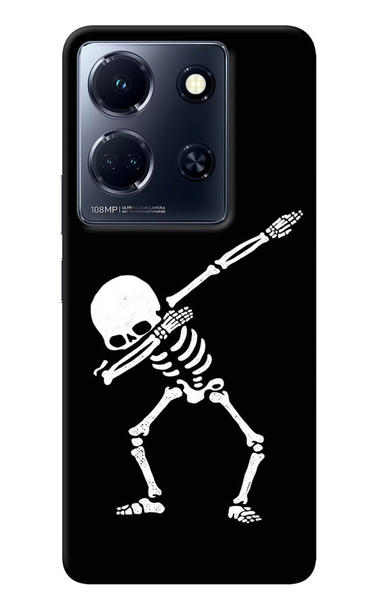 Dabbing Skeleton Art Infinix Note 30 5g Back Cover