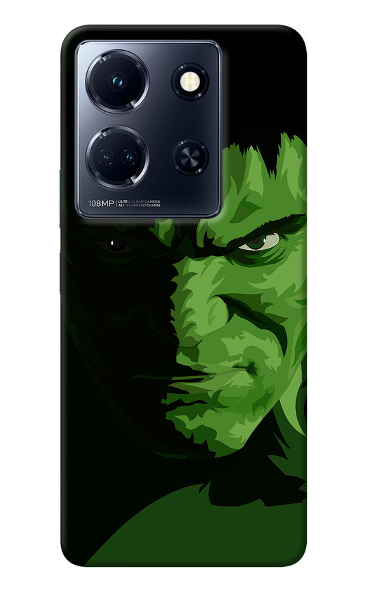 HULK Infinix Note 30 5g Back Cover